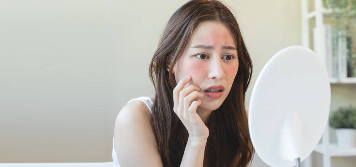 Histaminintoleranz: Erkennen der Symptome und Strategien zur Linderung 